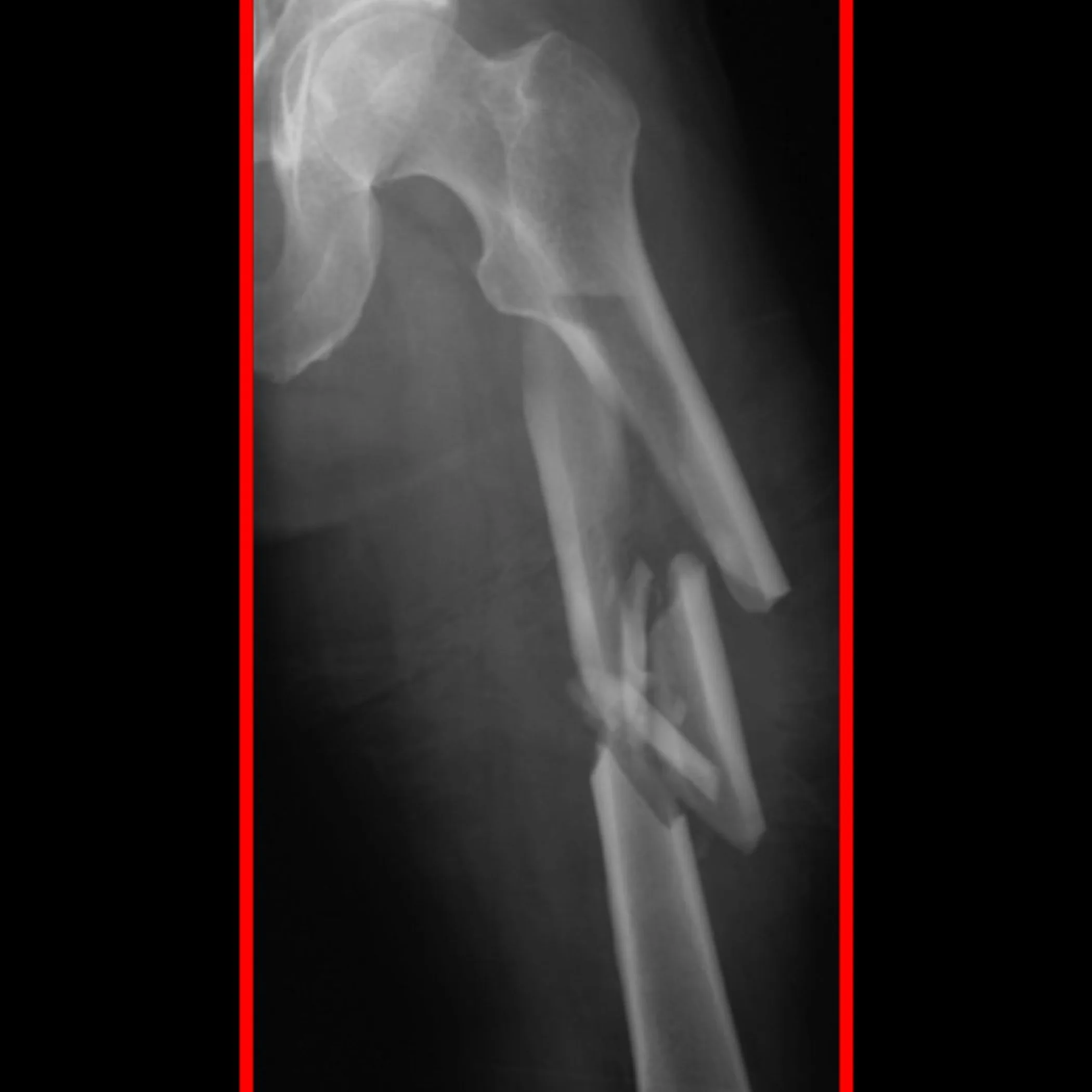 clear x-ray image related to surgery